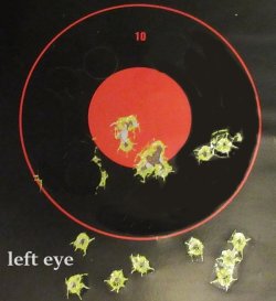 left eye.JPG