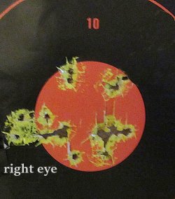 right eye.JPG